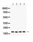 Anti-Cyclophilin A Picoband Antibody